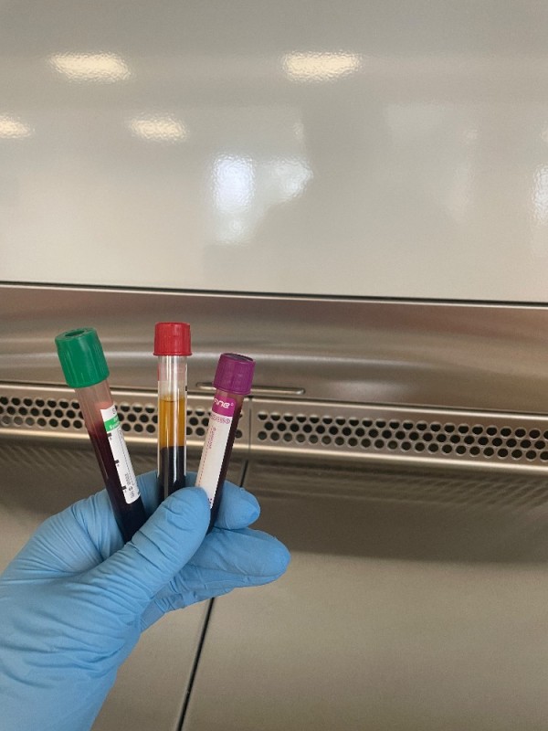 Create meme: t-spot.tb tuberculosis test, blood tubes by color, blood sampling tubes by color