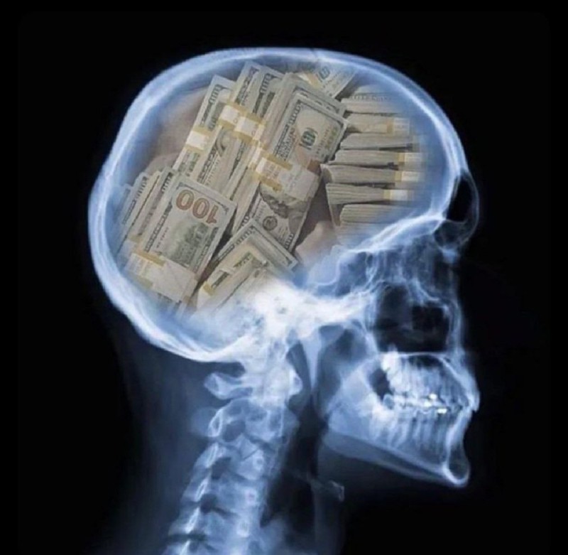 Create meme: x-rays of the brain, x-ray, head shot