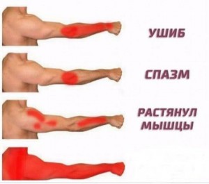 Create meme: causes of pain in the hands meme