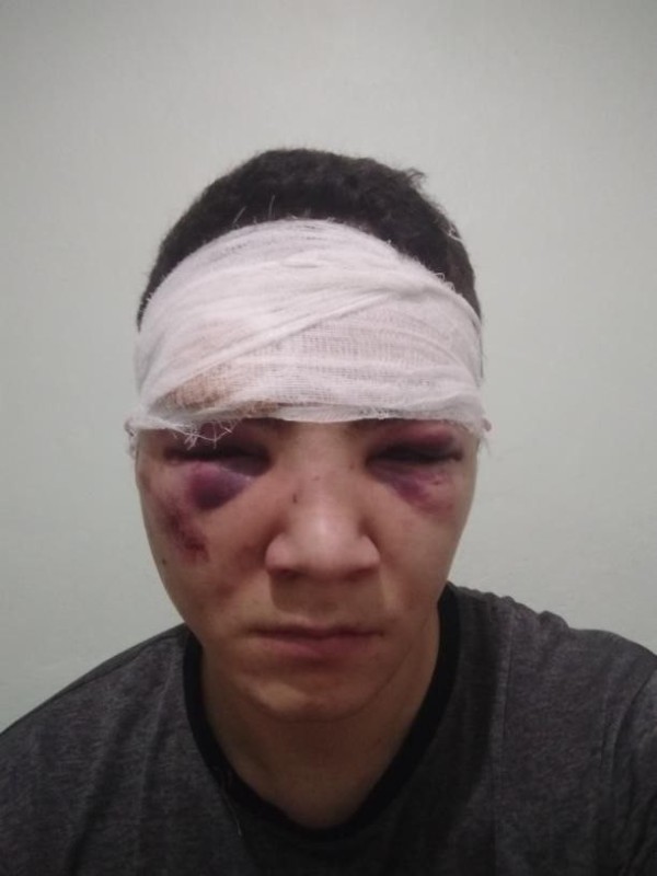 Create meme: Asian , Provodnikov's broken face, Ruslan Provodnikov with a broken face