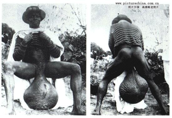 Create meme: large scrotum, the largest scrotum in the world, the largest scrotum