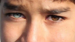 Create meme: heterochromia of the eyes in people