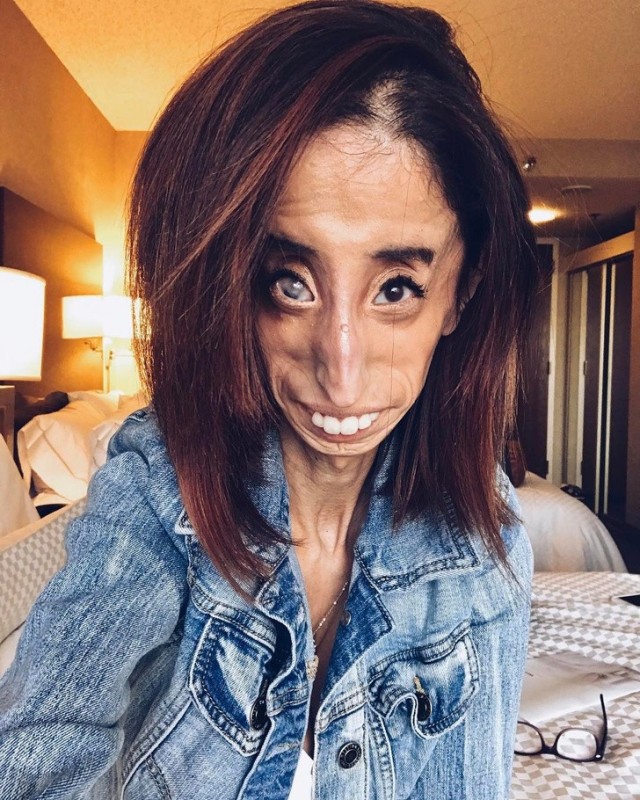 Create meme: Lizzie Velasquez, The ugliest girl in the world, the ugliest woman in the world