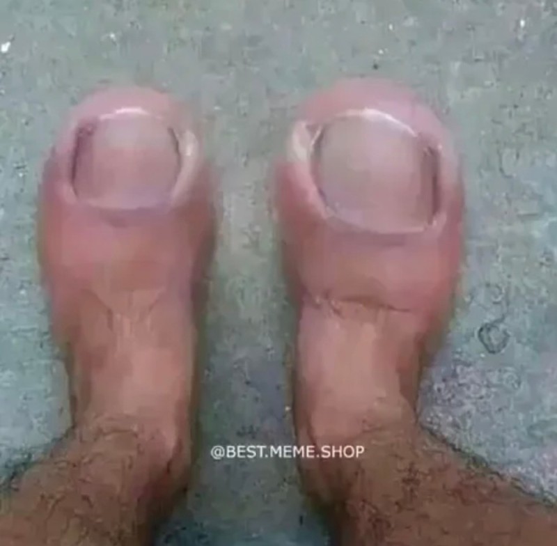 Create meme: big toes, men's toenails, foot fingers