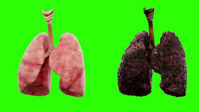 Create meme: lungs of a smoker, the lungs of a smoker and the lungs of a healthy person, the lungs of a smoker