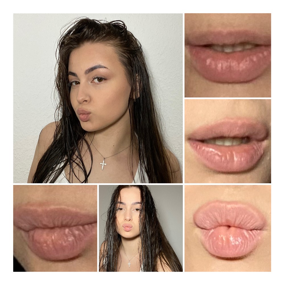 Create meme: the healing process of permanent lips by day, after lip augmentation, lip permanent healing by day