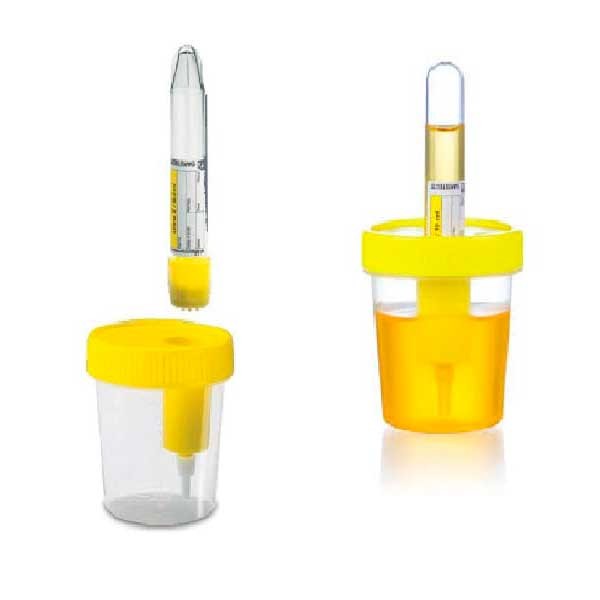 Создать мем: vacuette urine cup - контейнер для мочи, пробирка для мочи, шприц пробирка urine для сбора мочи