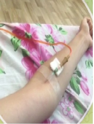 Create meme: iv on the hands, a girl's hand with a dropper, IV in the hospital