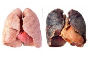 Create meme: lungs when Smoking, lungs of a smoker lungs are healthy, lungs of a smoker and a healthy person