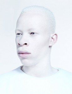 Create meme: Negro albino, people with albinism, albino