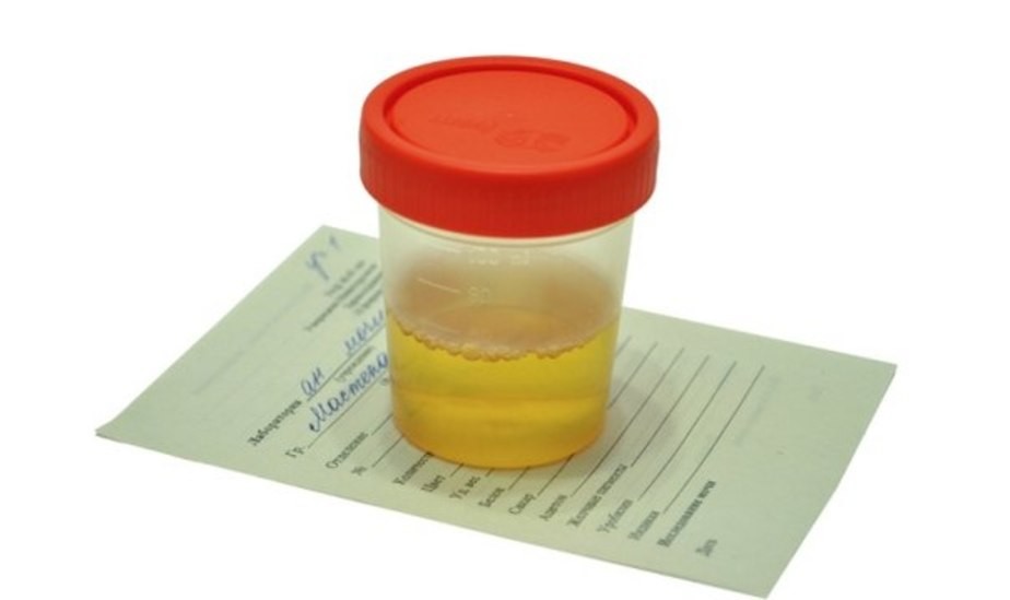 cloudy urine