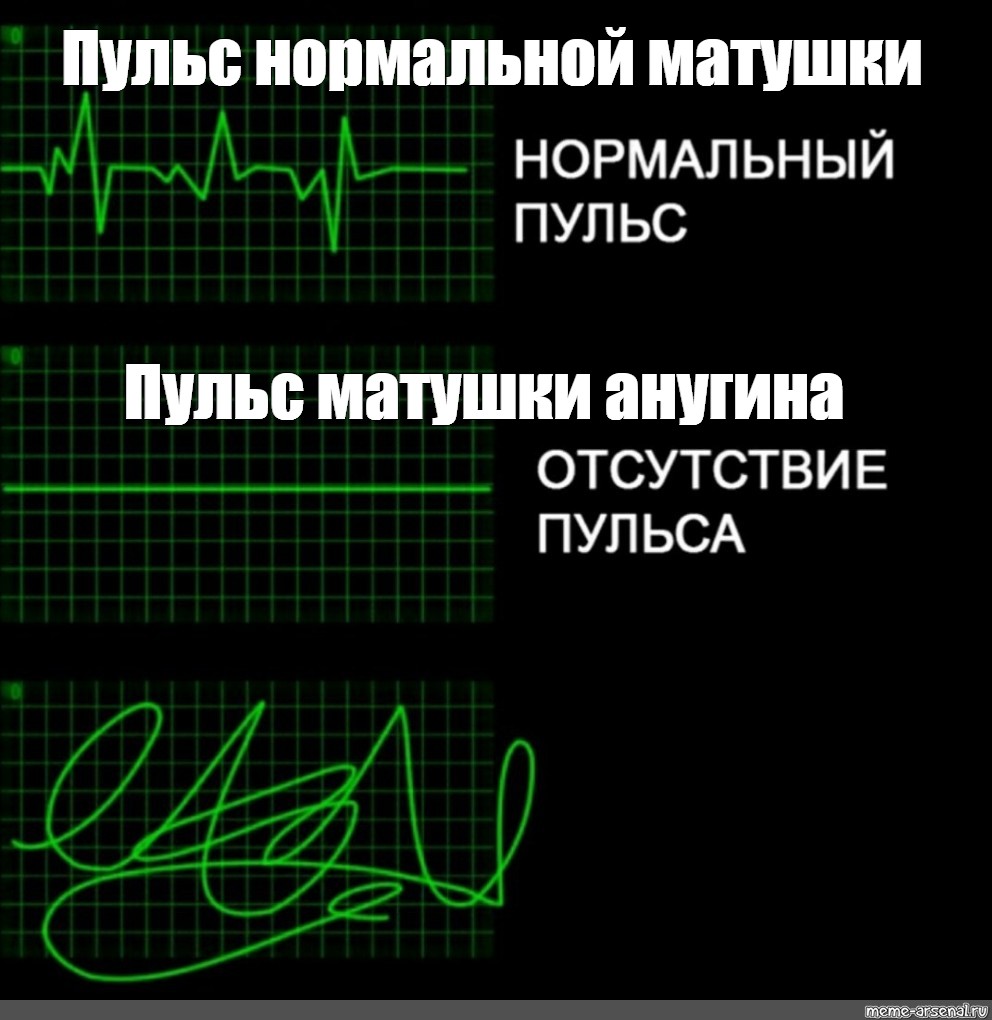 Текст песни с моего пульса убери руки. Пульс Мем. Сердцебиение Мем. Странный пульс. Мемы с пульсом.