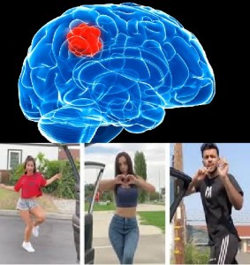 Create meme: brain tumor, glioblastoma brain, benign brain tumor
