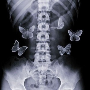 Создать мем: butterflies x ray aesthetic, бабочки в животе, рентген бабочки