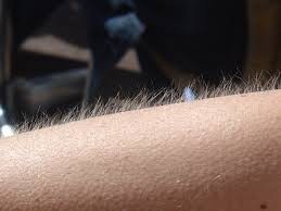 Create meme: meme goosebumps, goosebumps aesthetics, meme goosebumps on the skin