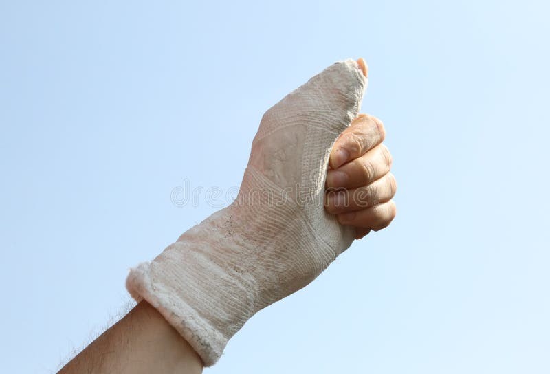 Create meme: plaster cast, cast on the thumb, body part