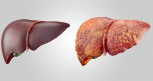 Create meme: hepatitis healthy liver, healthy and diseased liver, healthy liver and alcoholic liver