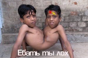 Create meme: Indian boy, Indian conjoined twins shivanath, conjoined twins in India
