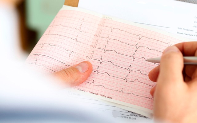 Create meme: ecg with transcription, ECG, cardiogram