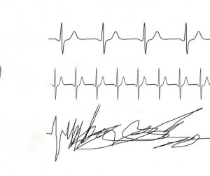 Create meme: cardiogram