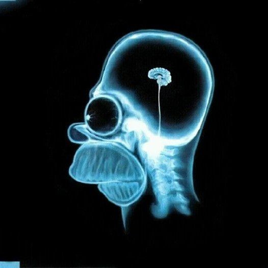 Create meme: Homer Simpson x-ray of the brain, brain Homer Simpson x-ray, x-rays of the brain