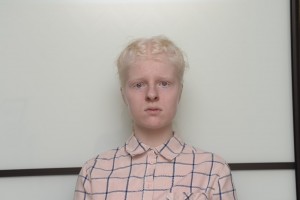Create meme: albinism, people with albinism, albino