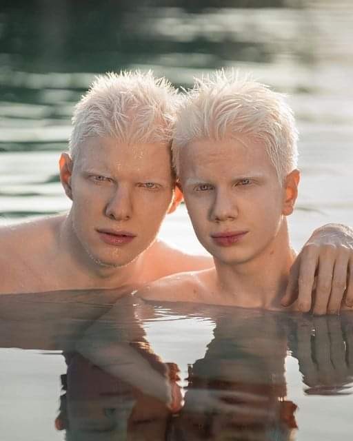 Create meme: albino model, albino , The albino male model