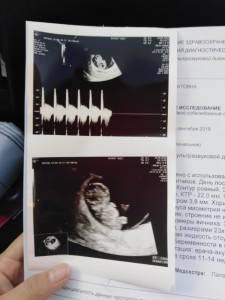 Create meme: screening, ultrasound 6 weeks pregnancy, ultrasound pictures of pregnancy