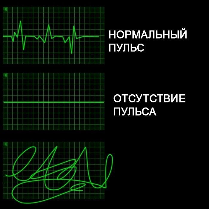 Create meme: lack of pulse, pulse, the normal heart rate