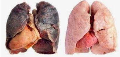 Create meme: the lungs of a smoker and a healthy person, lungs of a smoker, the lungs of a smoker and a healthy