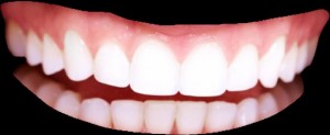 Create meme: front teeth, white teeth, teeth whitening
