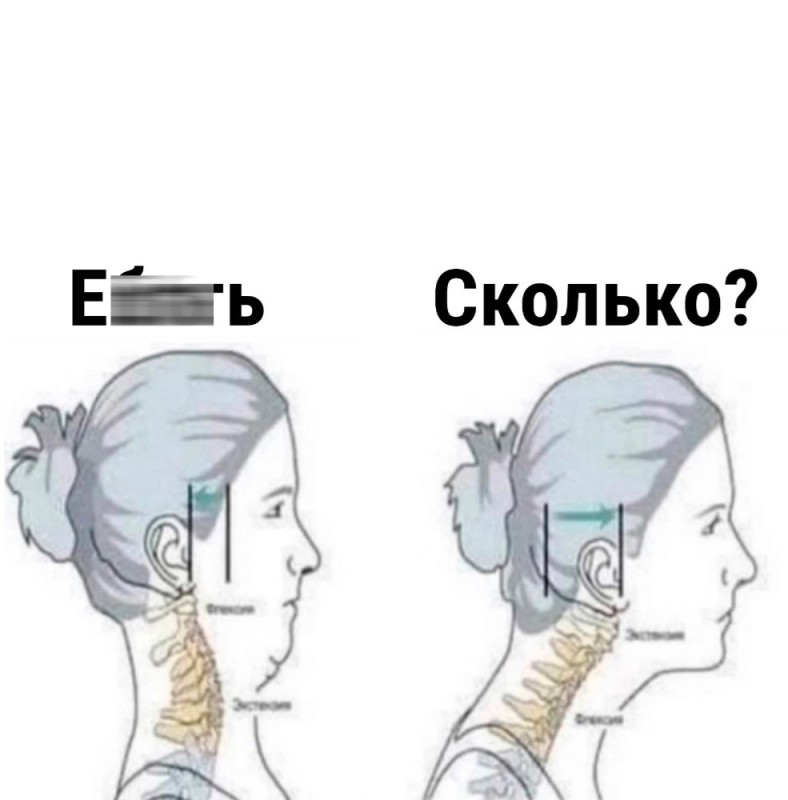 Create meme: cervical hyperlordosis, cervical spine, neck exercise