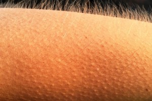 Create meme: goose bumps, goosebumps, goose bumps