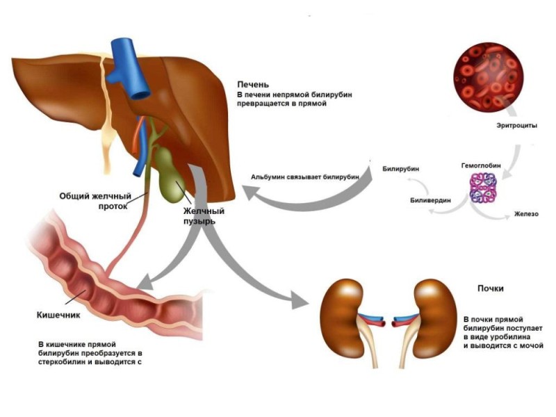 Create meme: blood bilirubin is direct and indirect., gilbert's syndrome bilirubin metabolism scheme, liver gallbladder