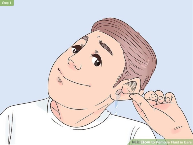 Create meme: wikiHow ears, Dr. Komarovsky, traces on the skin