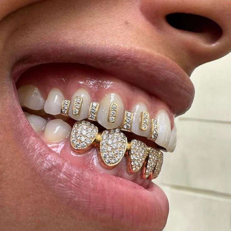 Create meme: grillz on the teeth, grills braces, grilz