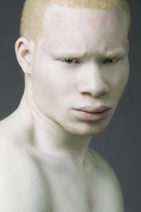 Create meme: Gemini albinos, albinos of different races, albinism