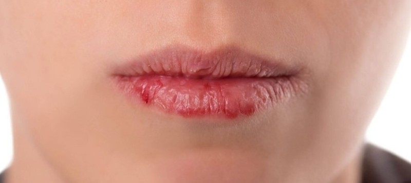 Create meme: middle lips, chapped lips, smooth lips