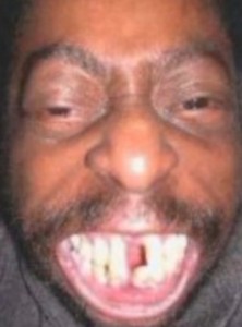 Create meme: teeth bum, a black man with no teeth, WAP