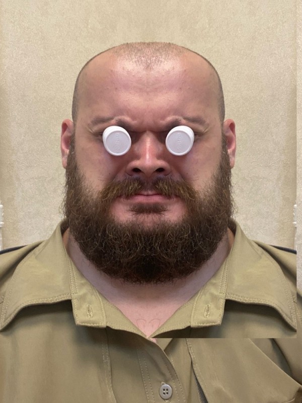 Create meme: Eggs on the eyes, male , funny human eyes