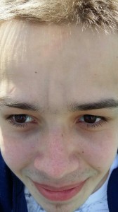 Create meme: pimples on forehead, face