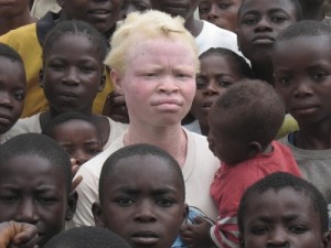 Create meme: there are ser, albinism, blue ebony