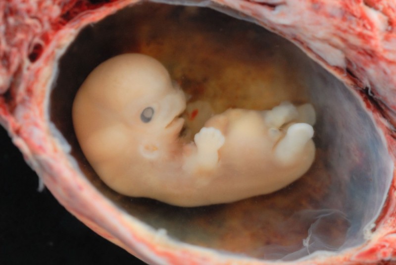 Create meme: human embryo, human embryo 8 weeks, embryo