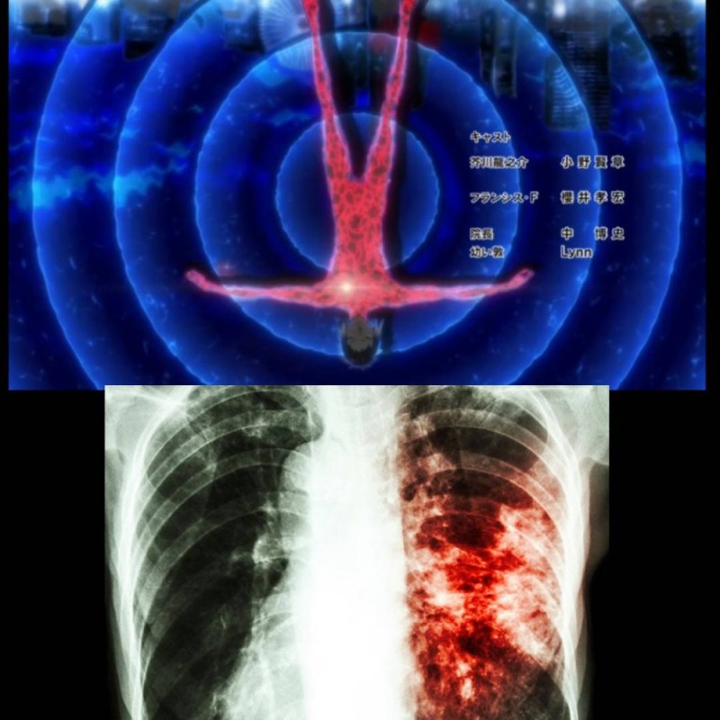 Create meme: lung cancer, lung tuberculosis, lung disease