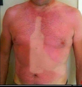 Create meme: burned in the sun, sunburn, sunburn