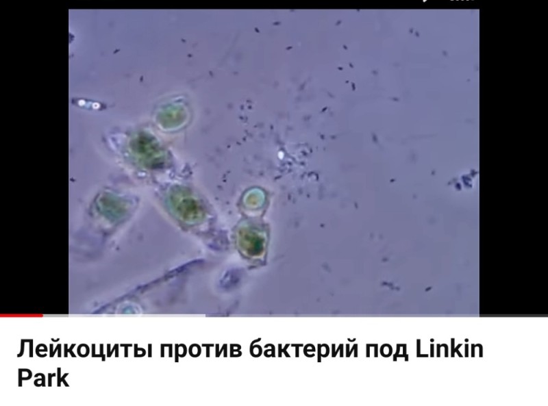 Create meme: leukocytes against bacteria under linkin park, leukocytes against bacteria under linkin park, microorganisms in water under a microscope
