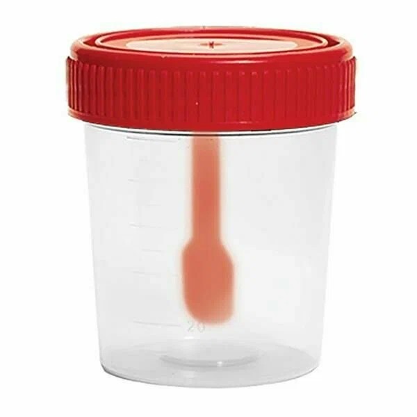 Create meme: container for biomaterials with a spoon of 60ml perint, jar for analysis, container d/bioassay 120 ml.