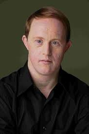 Create meme: Chris Burke, actors with down syndrome, Chris Burke actor