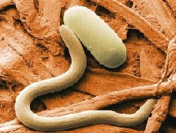 Create meme: nematode worms, worms, helminthiasis