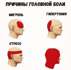 Create meme: types of headaches, the different types of headaches, causes of headache